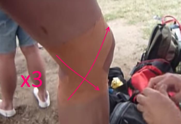 How to Strap a Knee 5