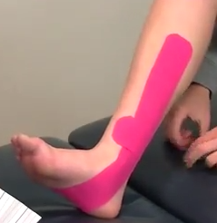 Goede How to Kinesiology Tape Shin Splints [updated] - SportStrap XX-62